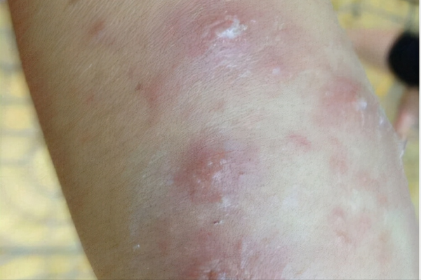 在草地上遇到這樣的土堆，請務必要遠離，它可能會要了你的命