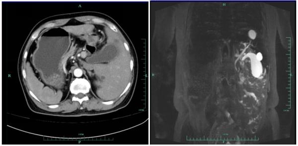 杭州6旬大伯五臟六腑全反了！醫生看呆……