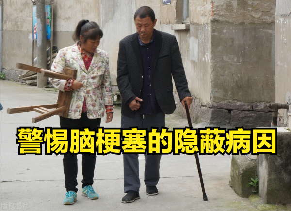 心梗患者一個疏忽,左心室出現血栓,最後發生腦梗塞!實在可惜 心梗患者一個疏忽,左心室出現血栓,最後發生腦梗塞!實在可惜