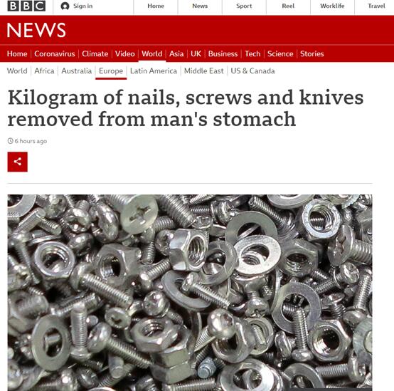 外媒:立陶宛一男子胃裡取出超一公斤重金屬異物,包括螺絲、螺母、刀片…… 外媒:立陶宛一男子胃裡取出超一公斤重金屬異物,包括螺絲、螺母、刀片……