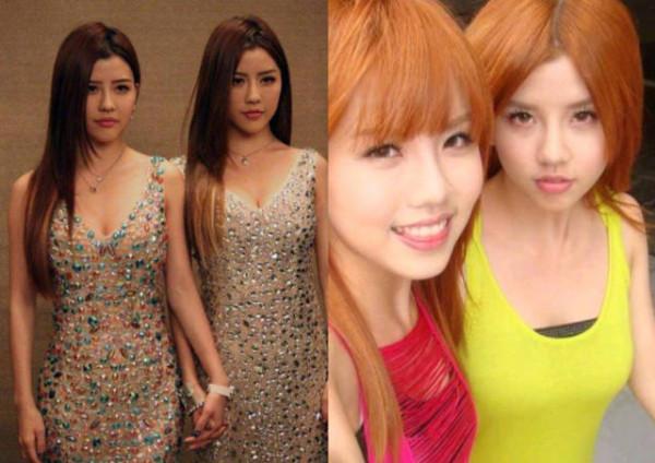 才華不夠的明星如何成長：被醫生縫合、剪掉胃…她們是怎麼不瘋的