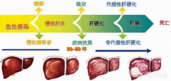 吃肝補肝是真的嗎？養肝護肝要注意什麼？不妨瞭解一下