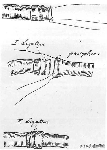 血管外科的起點