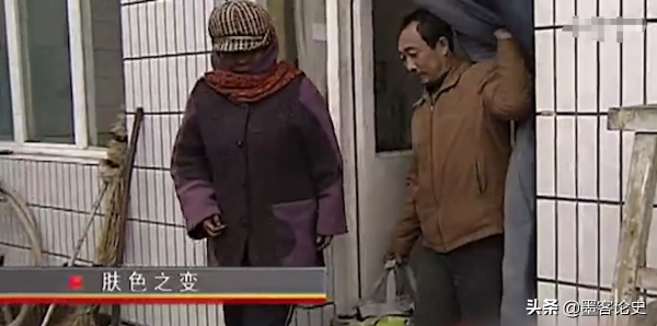 真實故事:山西45歲女子一夜變黑,體重急速增加,手術後讓家人落淚