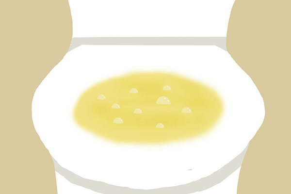 不想被尿毒症找上，早點改掉4大傷腎習慣，留意3個身體表現