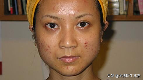 老中醫指出：都是腹脹腹瀉，成因卻截然不同，切不可盲目用藥