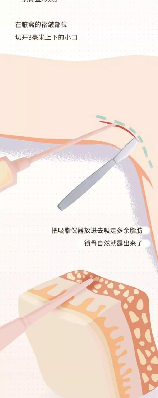 減肥也要健康減肥,不要盲目的崇拜快速瘦身!健康最重要(漫畫) 減肥也要健康減肥,不要盲目的崇拜快速瘦身!健康最重要(漫畫)