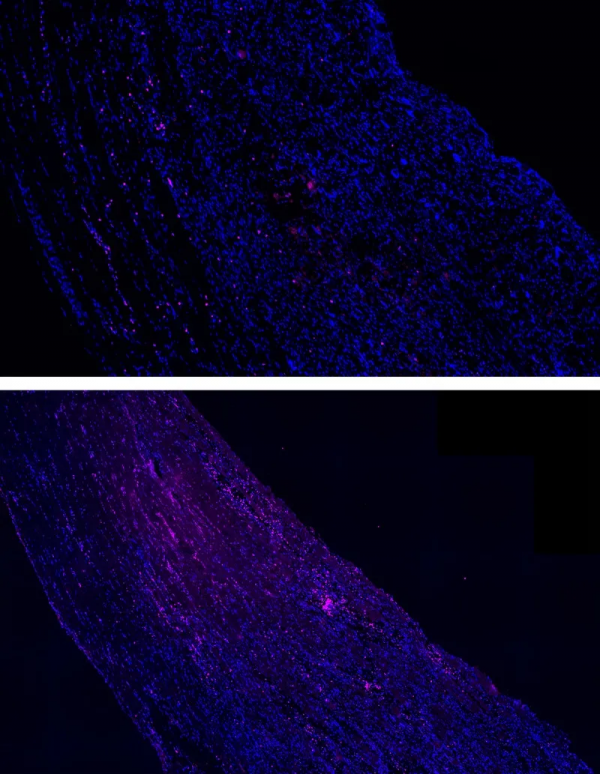 按摩有效得到科學證實!科學家首次揭示按摩促進肌肉修復的原理 按摩有效得到科學證實!科學家首次揭示按摩促進肌肉修復的原理