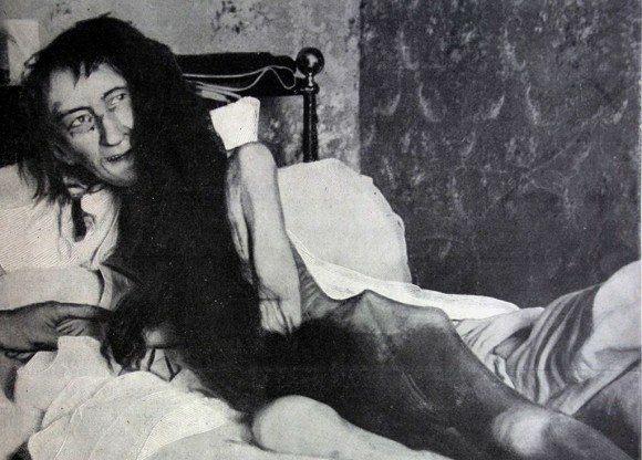 貴族名媛被囚禁25年,獲救時體重只剩25公斤,罪魁禍首竟然是親媽 貴族名媛被囚禁25年,獲救時體重只剩25公斤,罪魁禍首竟然是親媽