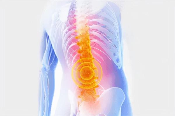 強直性脊柱炎不要只關注腰疼,這些危害你也要知道 強直性脊柱炎不要只關注腰疼,這些危害你也要知道