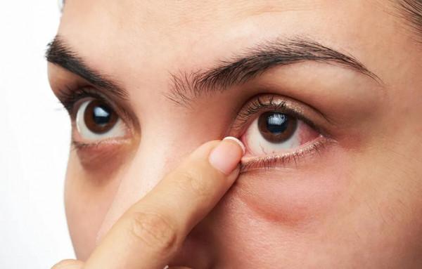 肝功能單純膽紅素升高,吃了很多藥都沒有效果?醫生給你分析病因 肝功能單純膽紅素升高,吃了很多藥都沒有效果?醫生給你分析病因