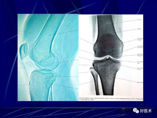 86張全身關節應用解剖精講，這篇文章值得收藏