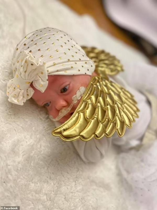 美國罕見雙子宮媽媽，一邊各懷一個娃，22周半早產只存活一個