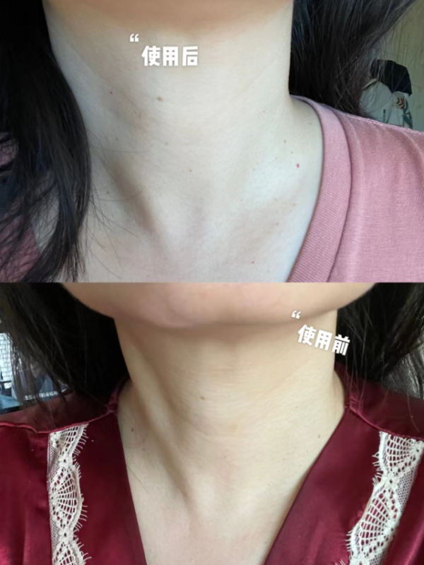 建議大家：逛超市的時候，遇到這3個老牌“萬能霜”，別錯過