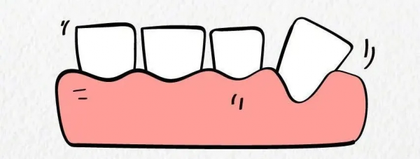 老人突然長新牙,是返老還童?還是患了癌症? 老人突然長新牙,是返老還童?還是患了癌症?