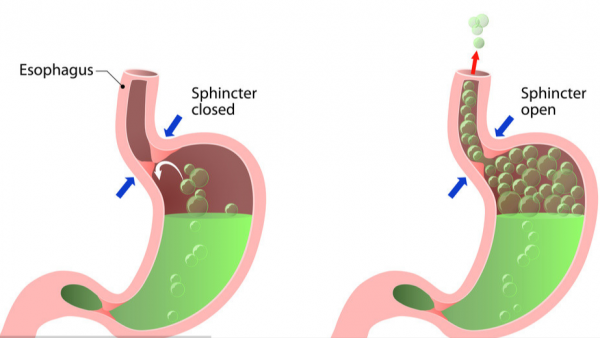 別再把消化不良當胃病！或許是膽囊不好了，聽聽醫生怎麼說