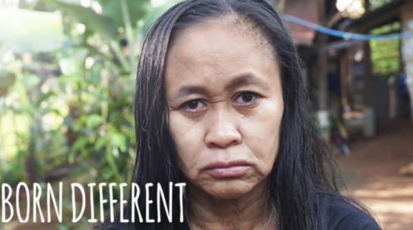 菲律賓16歲美少女,突然變成60歲老太太,顯得比母親還老,為啥? 菲律賓16歲美少女,突然變成60歲老太太,顯得比母親還老,為啥?