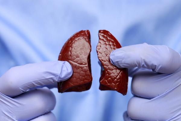 三年做兩次結石手術，還是常常不舒服，中醫一道妙方專門化石排石