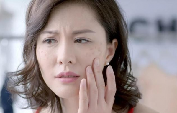 提醒：“三甜”傷臉，易長斑，建議女人少吃，面板也許慢慢變好