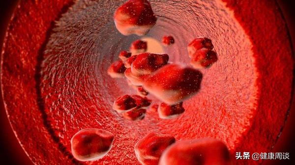 白天總是犯困，不一定是缺覺，可以檢查下供血情況，是否高壓高脂