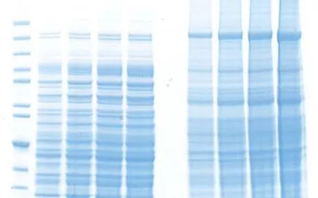 天能VE-586丨Western Blot蛋白免疫印跡常見問題