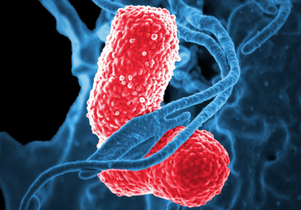 全世界每年有1.5億這種病例,而且女性發病率是男性的10倍 全世界每年有1.5億這種病例,而且女性發病率是男性的10倍