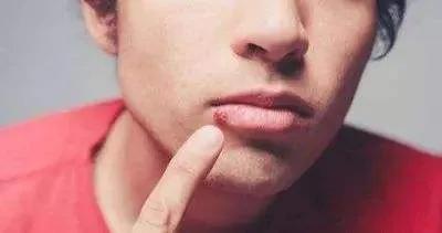 冬季上火怎麼辦，幾個妙招幫你解決上火煩惱，小妙招大用處