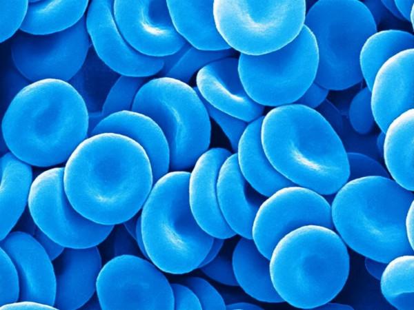 基因突變的藍色血液人及其藍色面板家族的真實故事