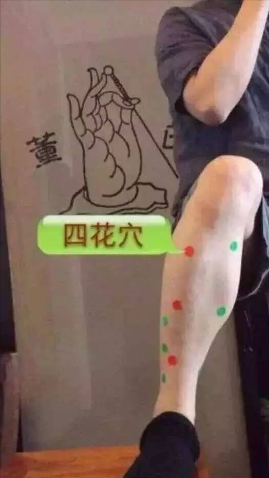 便秘可以透過針灸搞定嗎？值得收藏