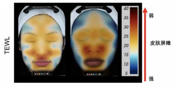 醜哭!唇周暗沉自救指南,做好這3件事讓你白回來 醜哭!唇周暗沉自救指南,做好這3件事讓你白回來