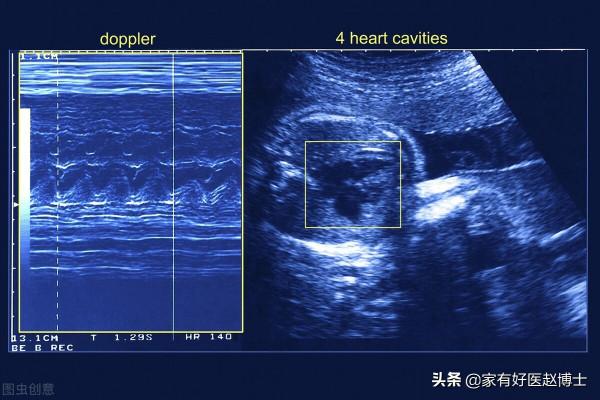 心臟彩超提示:左室舒張功能減退、瓣膜輕度反流,究竟嚴不嚴重? 心臟彩超提示:左室舒張功能減退、瓣膜輕度反流,究竟嚴不嚴重?