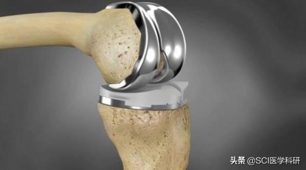 Nature子刊：“金屬骨頭”——鈦合金，可加速骨骼再生