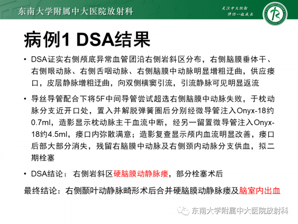 腦動靜脈畸形影像學特徵