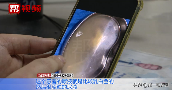 六旬阿姨排出“牛奶尿”？醫生：與這個飲食習慣有關