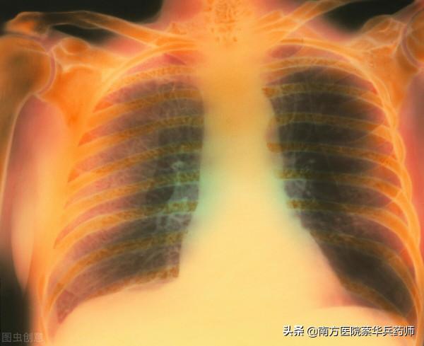 治療肺氣腫咳嗽痰多的中藥方子：苓甘五味姜辛湯，溫肺化痰保安康