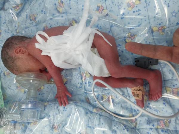 感嘆生命之頑強