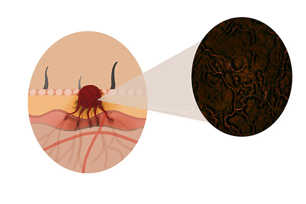“餓死癌細胞”並非謠言，合理禁食或能提高抗癌療效，該怎麼做？