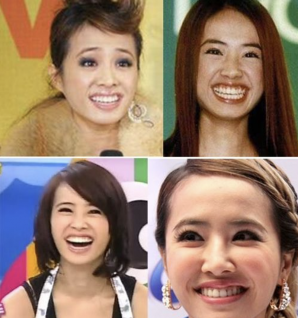 明星“社死”黑照，若能全網一鍵失憶，明星們最想刪除這些黑歷史