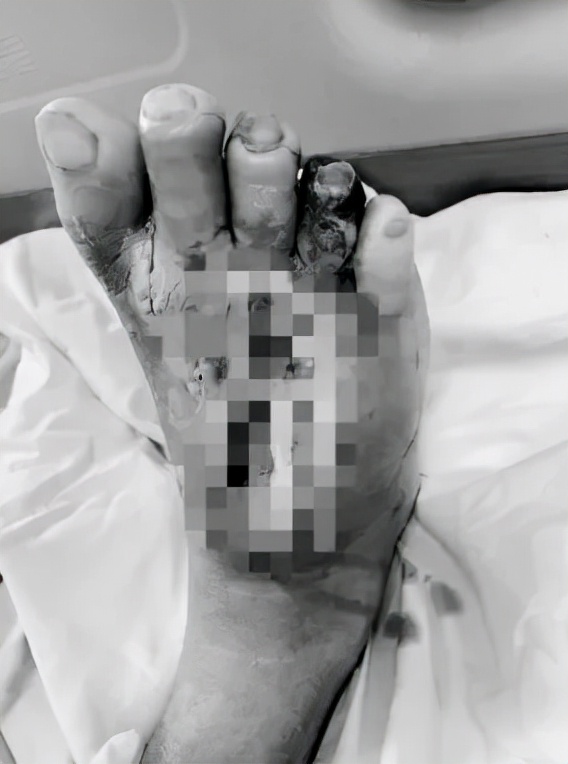 女子逛個沃爾瑪回來竟被截肢 怒告上法院 獲賠1000萬刀