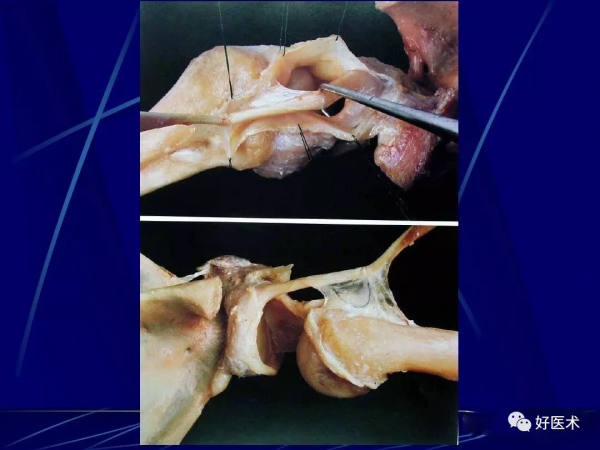 86張全身關節應用解剖精講，這篇文章值得收藏