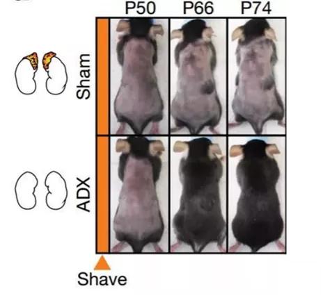 研究發現少白頭可能有機會復黑