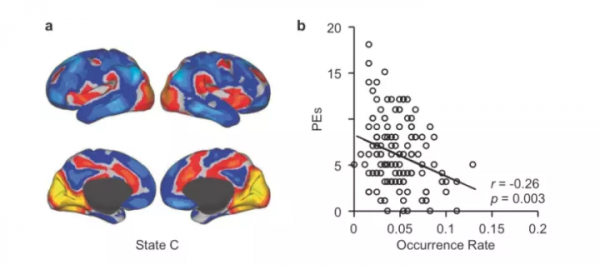 Nature子刊:劉河生教授發現精神疾病患者腦活動的核心紊亂z Nature子刊:劉河生教授發現精神疾病患者腦活動的核心紊亂z