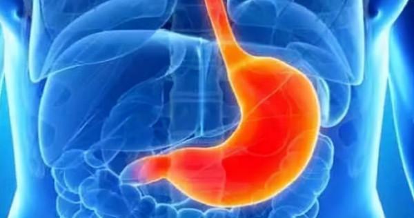 “羊肉”是胃病的發物嗎?醫生:要想養胃,3類食物儘量少碰 “羊肉”是胃病的發物嗎?醫生:要想養胃,3類食物儘量少碰