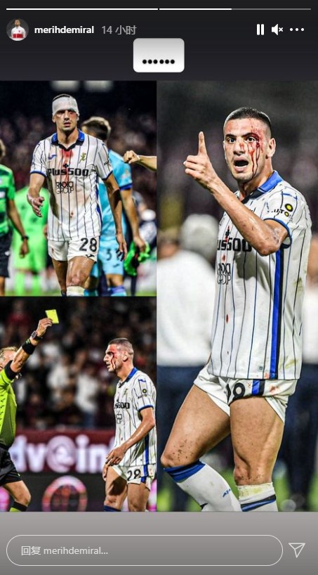 德米拉爾曬眉骨縫針照表達不滿：被肘擊之後我被出示了一張黃牌