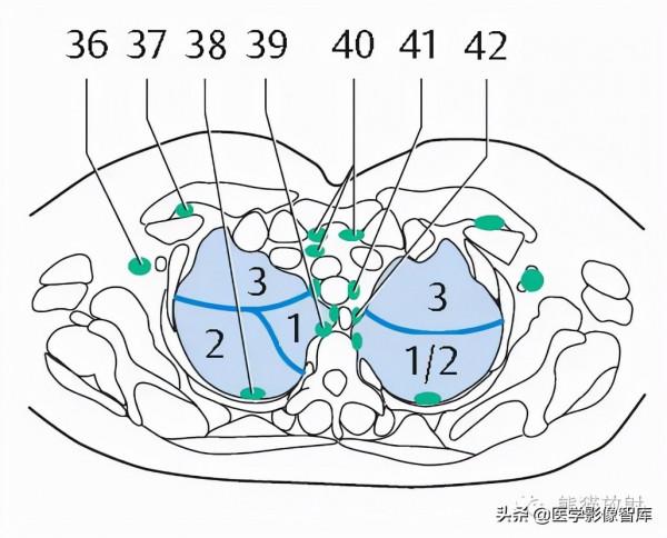 CT斷層解剖圖譜最全總結「推薦收藏」 CT斷層解剖圖譜最全總結「推薦收藏」