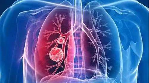 全球首個治療肺氣腫的重組蛋白藥物獲批