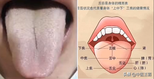 最近整理了一些粉絲的舌診分析，大家可以看看（每日舌象分析）