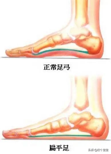 這幾種鞋最傷孩子，娃再喜歡也別穿！秋冬選鞋，這些標準缺一不可