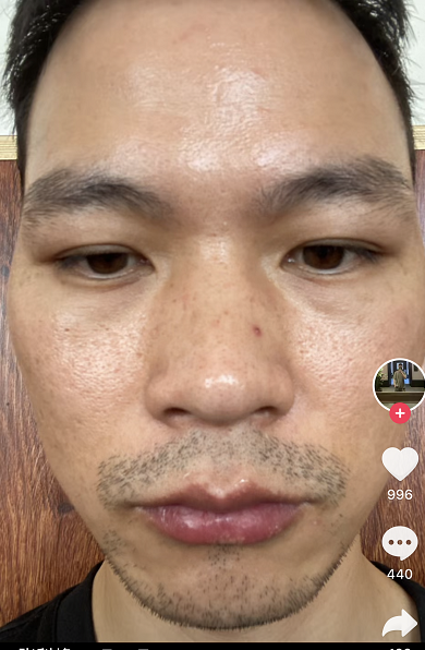 經歷“女海王”項思醒的張科峰，現在怎麼樣了？