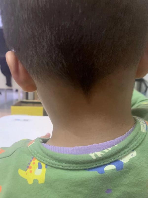 羊水穿刺到底有多疼—記錄我產檢過程中最煎熬的過程 羊水穿刺到底有多疼—記錄我產檢過程中最煎熬的過程